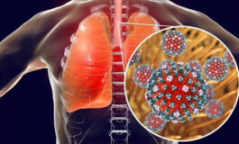 H3N2 EM VILHENA: explosão de casos de vilhenenses com sintomas gripais revela possível surto de nova variante em Vilhena